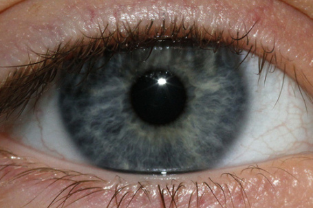 mavi gözde tyndall etkisi 